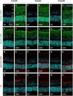 Retinal alpha-synuclein accumulation correlates with retinal dysfunction and structural thinning in the A53T mouse model of Parkinson’s disease